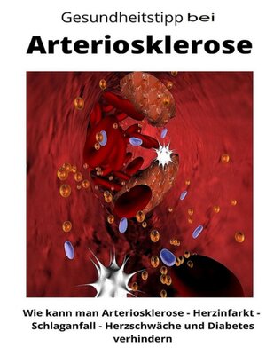 cover image of Gesundheitstipp bei Arteriosklerose